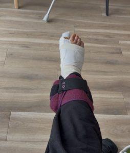 Physiotherapie nach hallux-valgus-op